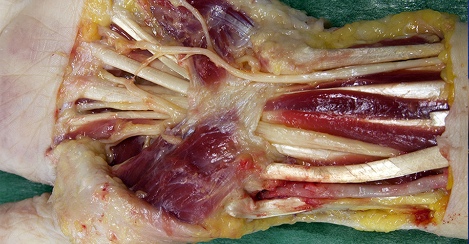 carpal region