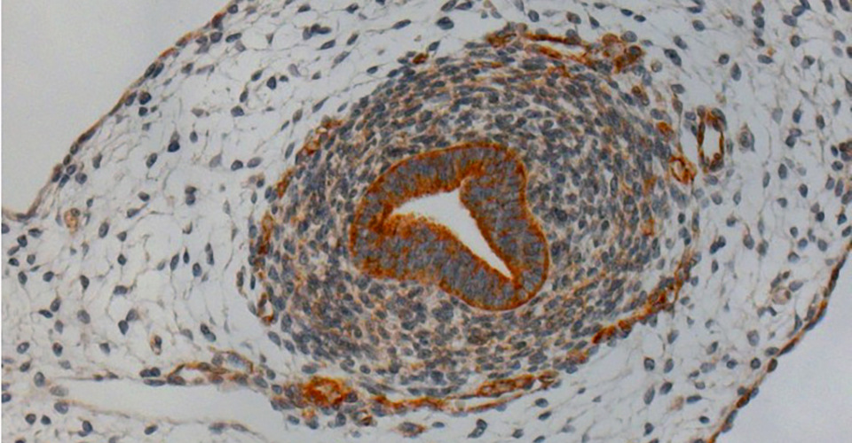 expression of OVGP1 in fetal week 11 in the developing human Fallopian tube