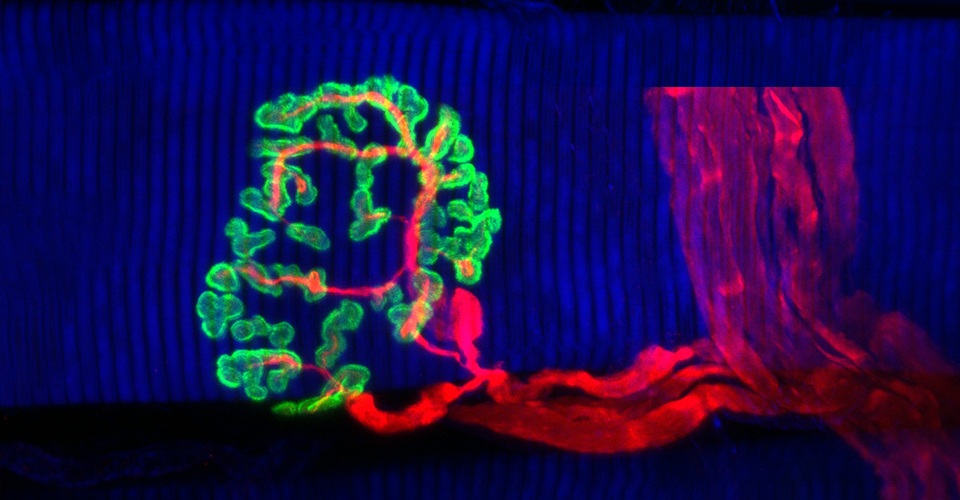 CLSM image of a motor endplate.
                   The nerve fibers (red) are visualized with anti-neurofilament and the
				   motor endplate (green) with alpha-bungarotoxin. The muscle fibers (blue)
				   are visualized with phalloidin. (Ao. Prof. Dr. Roland Blumer, Center of Anatomy and Cell Biology)